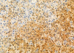 GSTA1 Polyclonal Antibody:Antibodies, Polyclonal