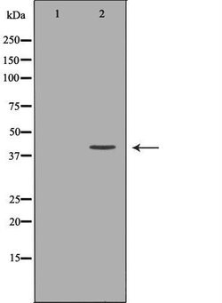 Invitrogen DTNBP1 Polyclonal Antibody 100 &mu;L; Unconjugated:Antibodies,