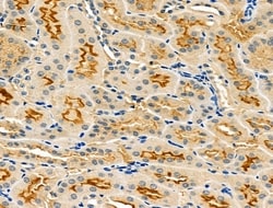LOX-1 Polyclonal Antibody:Antibodies, Polyclonal