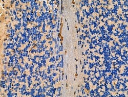 LOX-1 Polyclonal Antibody:Antibodies, Polyclonal