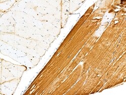 LOX-1 Polyclonal Antibody:Antibodies, Polyclonal
