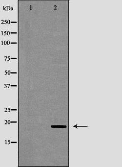Invitrogen™ Cathelicidin Polyclonal Antibody