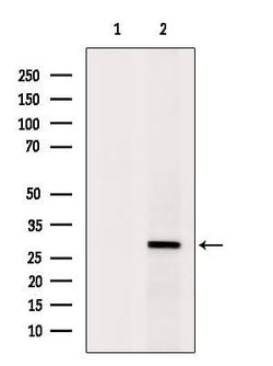 Invitrogen SRSF1 Polyclonal Antibody 100 &mu;L | Buy Online | Invitrogen&trade; | Fisher Scientific