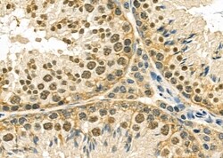 Invitrogen PTHLH Polyclonal Antibody 100 &mu;L; Unconjugated:Antibodies,
