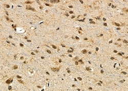 Invitrogen PTHLH Polyclonal Antibody 100 &mu;L; Unconjugated:Antibodies,