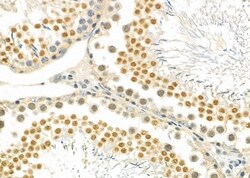 Invitrogen PTHLH Polyclonal Antibody 100 &mu;L; Unconjugated:Antibodies,