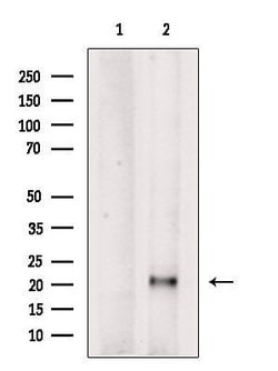 Invitrogen PTHLH Polyclonal Antibody 100 &mu;L; Unconjugated:Antibodies,