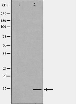 Invitrogen SAA1/SAA2 Polyclonal Antibody 100 &mu;L; Unconjugated:Antibodies,