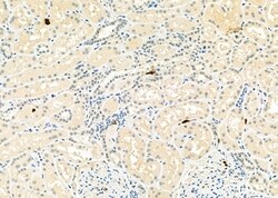 Invitrogen CD162 Polyclonal Antibody 100 &mu;L | Buy Online | Invitrogen&trade; | Fisher Scientific