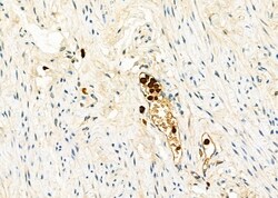 Invitrogen CD162 Polyclonal Antibody 100 &mu;L | Buy Online | Invitrogen&trade; | Fisher Scientific