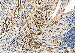 Invitrogen CD162 Polyclonal Antibody 100 &mu;L | Buy Online | Invitrogen&trade; | Fisher Scientific