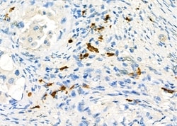 Invitrogen CD162 Polyclonal Antibody 100 &mu;L | Buy Online | Invitrogen&trade; | Fisher Scientific