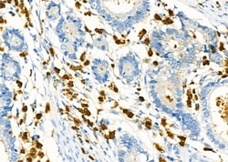 Invitrogen CD162 Polyclonal Antibody 100 &mu;L | Buy Online | Invitrogen&trade; | Fisher Scientific