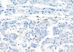 Invitrogen CD162 Polyclonal Antibody 100 &mu;L | Buy Online | Invitrogen&trade; | Fisher Scientific