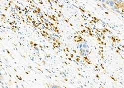 Invitrogen CD162 Polyclonal Antibody 100 &mu;L | Buy Online | Invitrogen&trade; | Fisher Scientific