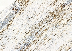 Invitrogen CD162 Polyclonal Antibody 100 &mu;L | Buy Online | Invitrogen&trade; | Fisher Scientific