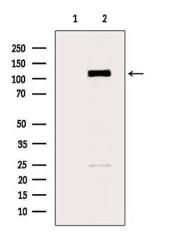 Invitrogen CD162 Polyclonal Antibody 100 &mu;L | Buy Online | Invitrogen&trade; | Fisher Scientific