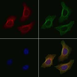 Invitrogen SLC22A5 Polyclonal Antibody 100 &mu;L; Unconjugated:Antibodies,