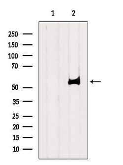 Invitrogen SLC22A5 Polyclonal Antibody 100 &mu;L; Unconjugated:Antibodies,