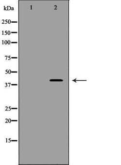 Invitrogen CDK7 Polyclonal Antibody 100 &mu;L; Unconjugated:Antibodies,