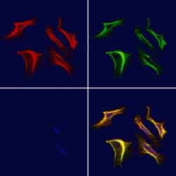 Invitrogen KIR2DL3 Polyclonal Antibody 100 &mu;L; Unconjugated:Antibodies,