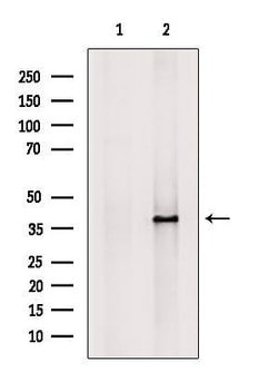 Invitrogen KIR2DL3 Polyclonal Antibody 100 &mu;L; Unconjugated:Antibodies,