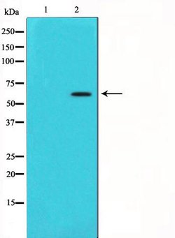 Invitrogen CYP11A1 Polyclonal Antibody 100 &mu;L; Unconjugated:Antibodies,