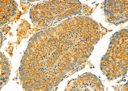 Invitrogen Uteroglobin Polyclonal Antibody 100 &mu;L; Unconjugated:Antibodies,