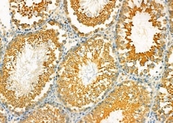 Invitrogen Uteroglobin Polyclonal Antibody 100 &mu;L; Unconjugated:Antibodies,