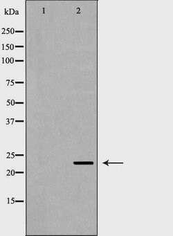 FXN Polyclonal Antibody:Antibodies, Polyclonal