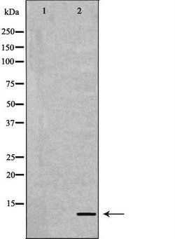 Invitrogen APOC2 Polyclonal Antibody 100 &mu;L; Unconjugated:Antibodies,