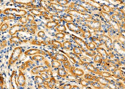 Invitrogen HMBS Polyclonal Antibody 100 &mu;L; Unconjugated:Antibodies,