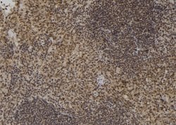 Invitrogen XRCC2 Polyclonal Antibody 100 &mu;L; Unconjugated:Antibodies,