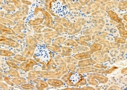 Invitrogen SLC22A6 Polyclonal Antibody 100 &mu;L | Buy Online | Invitrogen&trade; | Fisher Scientific