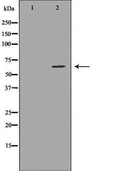 Invitrogen IL10RA Polyclonal Antibody 100 &mu;L; Unconjugated:Antibodies,