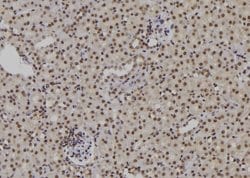 Invitrogen POLH Polyclonal Antibody 100 &mu;L; Unconjugated:Antibodies,