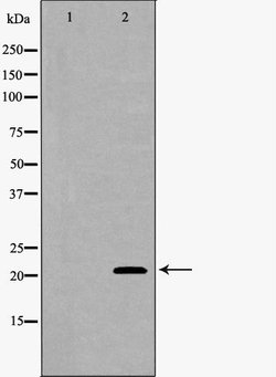 SFTPC Polyclonal Antibody, Invitrogen 100 &mu;L; Unconjugated:Antibodies,
