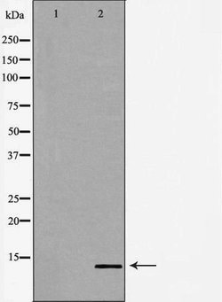 Invitrogen POLR2J Polyclonal Antibody 100 &mu;L; Unconjugated:Antibodies,