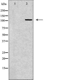 Invitrogen RPGR Polyclonal Antibody 100 &mu;L; Unconjugated:Antibodies,
