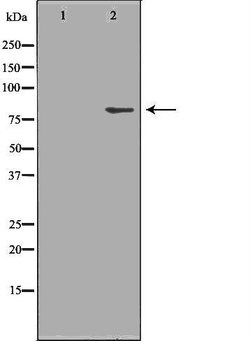 beta Galactosidase Polyclonal Antibody:Antibodies, Polyclonal