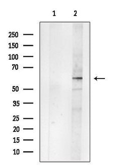 Invitrogen GABRB2 Polyclonal Antibody 100 &mu;L; Unconjugated:Antibodies,