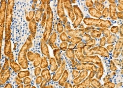 Invitrogen ANT Polyclonal Antibody 100 &mu;L; Unconjugated:Antibodies,