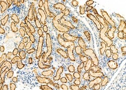 Invitrogen ANT Polyclonal Antibody 100 &mu;L; Unconjugated:Antibodies,