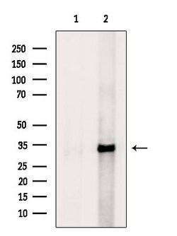 Invitrogen ANT Polyclonal Antibody 100 &mu;L; Unconjugated:Antibodies,