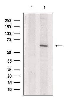 Invitrogen EPHX2 Polyclonal Antibody 100 &mu;L; Unconjugated:Antibodies,