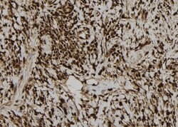 Invitrogen DNA Ligase III Polyclonal Antibody 100 &mu;L; Unconjugated:Antibodies,