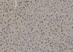 Invitrogen RAD9 Polyclonal Antibody 100 &mu;L; Unconjugated:Antibodies,