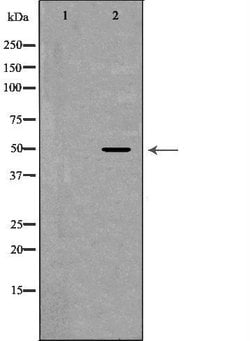 Invitrogen CADM1 Polyclonal Antibody 100 &mu;L; Unconjugated:Antibodies,