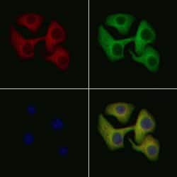 Invitrogen IL1R2 Polyclonal Antibody 100 &mu;L; Unconjugated:Antibodies,