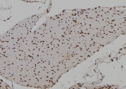 Invitrogen HOXA9 Polyclonal Antibody 100 &mu;L; Unconjugated:Antibodies,